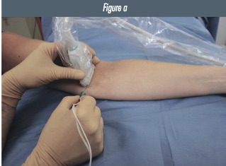 Fig 1a