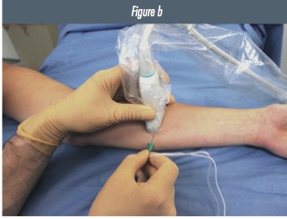 Fig 1b