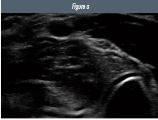 Fig 2a