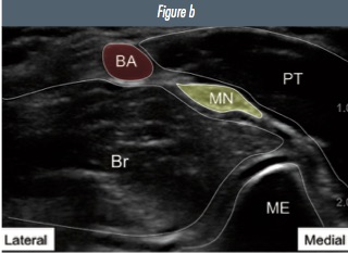 Fig 2b