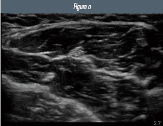 Fig 3a