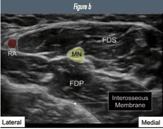 Fig 3b