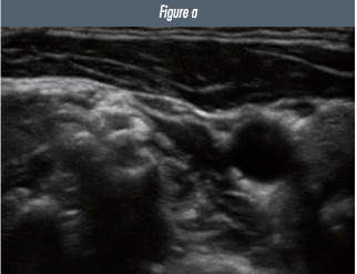 Figure 2a